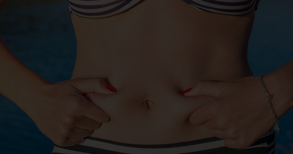 Woman wearing a bikini and pinching the fat on her stomach.